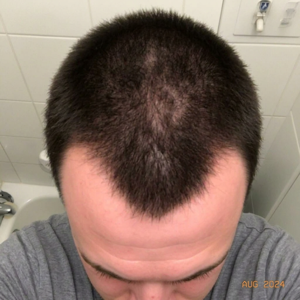 Month 8 scalp photo