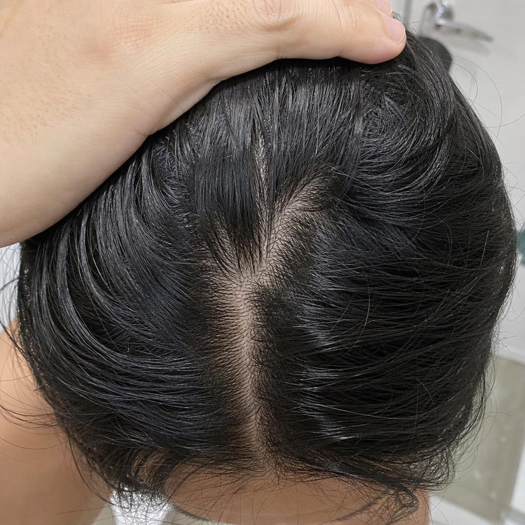 Macro scalp