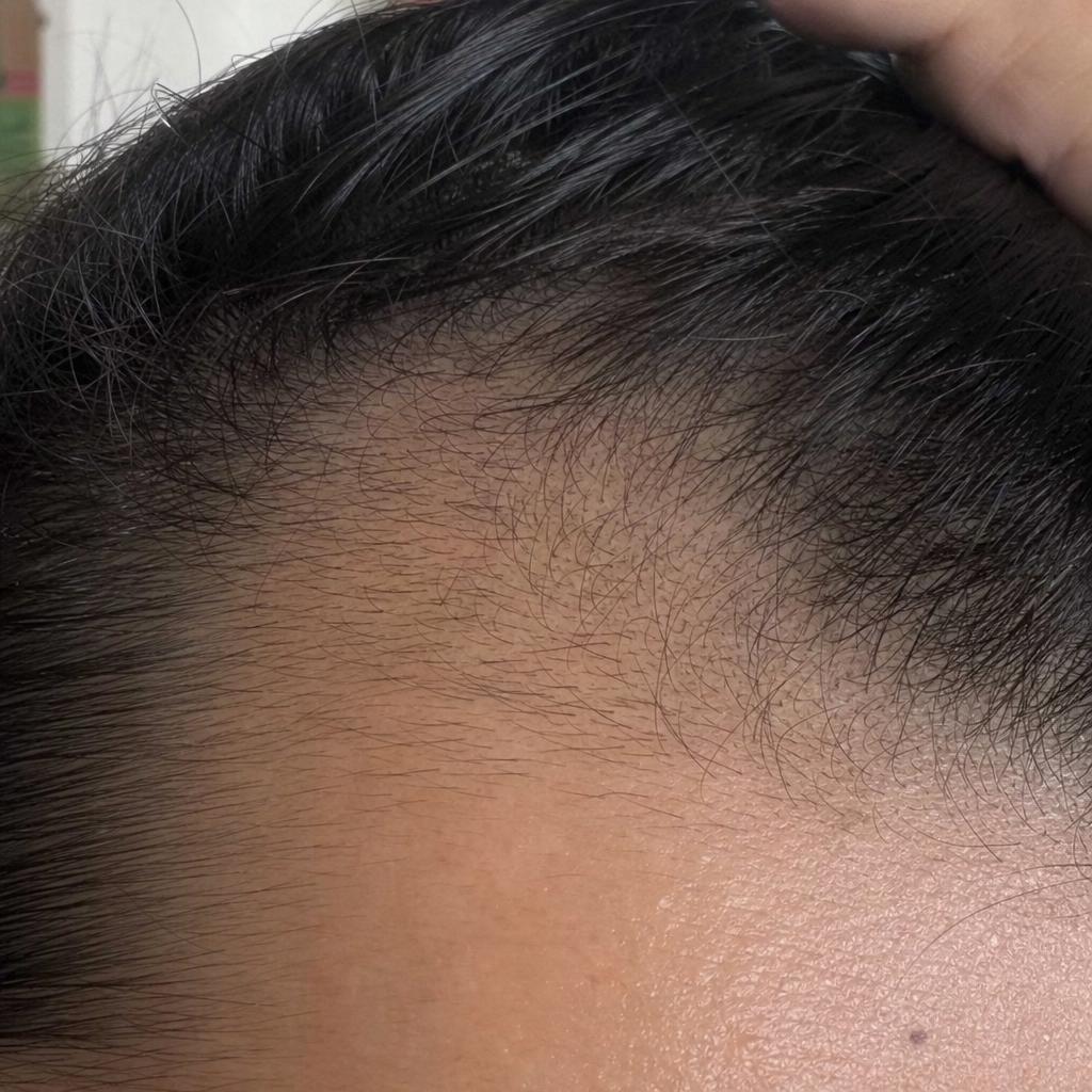 Regrowth